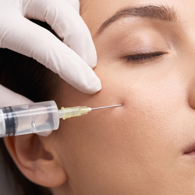 Dermal Fillers